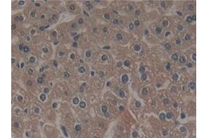 Detection of NCF4 in Mouse Liver Tissue using Polyclonal Antibody to Neutrophil Cytosolic Factor 4 (NCF4) (NCF4 抗体  (AA 111-339))