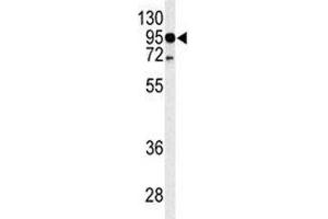 Western blot analysis of TLR4 antibody and HL-60 lysate. (TLR4 抗体  (AA 669-698))