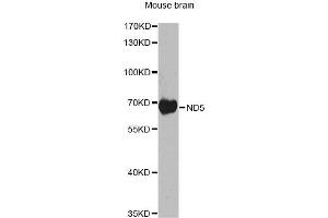 Western blot analysis of extracts of mouse brain, using ND5 antibody. (MT-ND5 抗体)