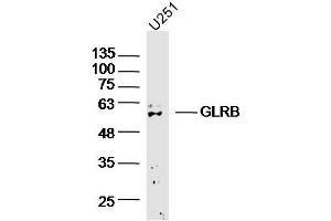 U251 cell lysates probed with GLRB Polyclonal Antibody, Unconjugated (bs-20450R) at 1:300 overnight at 4˚C. (GLRB 抗体  (AA 51-150))
