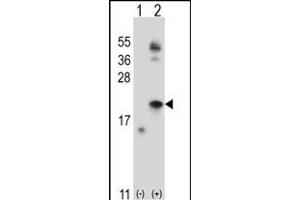 Western blot analysis of IL21 (arrow) using rabbit polyclonal IL21 Antibody (C-term) (ABIN657761 and ABIN2846740). (IL-21 抗体  (C-Term))