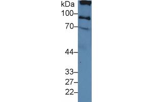Western blot analysis of Human Serum, using Human ITIH2 Antibody (3 µg/ml) and HRP-conjugated Goat Anti-Rabbit antibody ( (ITIH2 抗体  (AA 452-702))