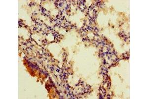 Immunohistochemistry of paraffin-embedded human lung tissue using ABIN7167709 at dilution of 1:100 (RGMA 抗体  (AA 153-408))