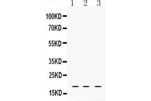 Western blot analysis of LMO1 expression in rat brain extract ( Lane 1), NIH3T3 whole cell lysates ( Lane 2) and HELA whole cell lysates ( Lane 3). (LMO1 抗体  (C-Term))