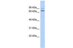 TPRN anticorps  (AA 420-469)