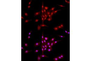 Immunofluorescence (IF) image for anti-Ligase III, DNA, ATP-Dependent (LIG3) (AA 730-1009) antibody (ABIN6143207)