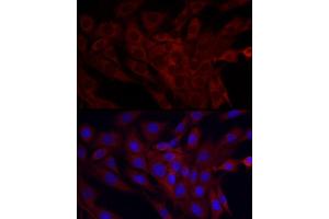 Immunofluorescence (IF) image for anti-Signal Recognition Particle 72kDa (SRP72) antibody (ABIN6134166)