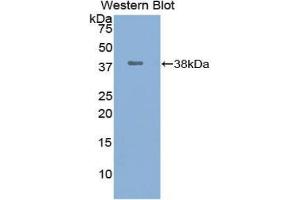 Western blot analysis of the recombinant protein. (UCHL5 抗体  (C-Term))