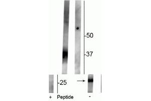 Western blot of rat kidney lysate showing specific immunolabeling of the ~29 kDa and 37 kDa glycosylated form of the AQP2 protein phosphorylated at Ser261 in the first lane (-). (AQP2 抗体  (pSer261))