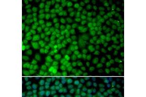 Immunofluorescence analysis of MCF-7 cells using RBX1 Polyclonal Antibody (RBX1 抗体)