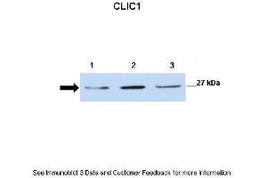 Western Blotting (WB) image for anti-Chloride Intracellular Channel 1 (CLIC1) (N-Term) antibody (ABIN2776130)