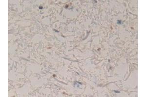 Immunohistochemistry (IHC) image for anti-Coronin, Actin Binding Protein, 1A (CORO1A) (AA 7-204) antibody (ABIN7436672)
