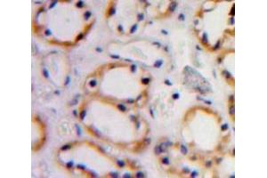 #VALUE! (Cadherin 5 抗体  (AA 68-307))