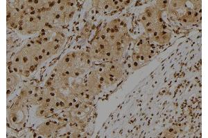 ABIN6275419 at 1/100 staining Human kidney tissue by IHC-P. (S100A3 抗体  (Internal Region))