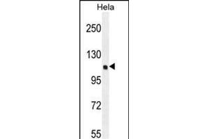 KI Antibody (C-term) (ABIN655488 and ABIN2845010) western blot analysis in Hela cell line lysates (35 μg/lane). (KIAA0999 (AA 1233-1263), (C-Term) 抗体)