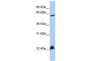 Western Blotting (WB) image for anti-Mahogunin, Ring Finger 1 (MGRN1) antibody (ABIN2458716) (Mahogunin RING Finger Protein 1 抗体)