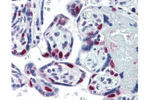 Anti-PARP antibody IHC of human placenta. (PARP1 抗体)