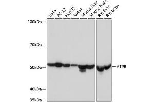 Western blot analysis of extracts of various cell lines, using ATPB Rabbit mAb (ABIN7265722) at 1:1000 dilution. (ATP5B 抗体)