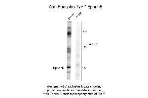 Western Blot of Anti-EphrinB pT317 (Rabbit) Antibody - 600-401-D36 Western Blot of Anti-EphrinB pT317 (Rabbit) Antibody. (Ephrin B 抗体  (pTyr317))