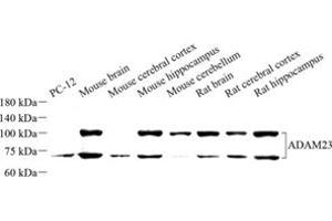 Western blot analysis of ADAM23 (ABIN7072942) at dilution of 1: 500