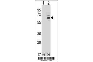 Western blot analysis of FASTK using rabbit polyclonal FASTK Antibody using 293 cell lysates (2 ug/lane) either nontransfected (Lane 1) or transiently transfected (Lane 2) with the FASTK gene. (FASTK 抗体  (C-Term))