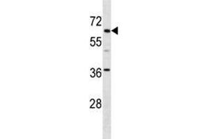 TFE3 antibody western blot analysis in mouse kidney tissue lysate. (TFE3 抗体  (AA 489-516))