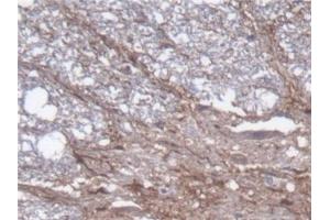 Detection of GFAP in Rat Spinal cord Tissue using Polyclonal Antibody to Glial Fibrillary Acidic Protein (GFAP) (GFAP 抗体  (AA 1-430))