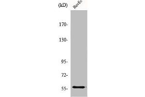 Western Blot analysis of HuvEc cells using MMP-19 Polyclonal Antibody (MMP19 抗体  (N-Term))