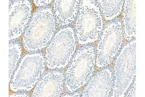 ABIN6260703 and ABIN6268787 at 1/100 staining Rat testis tissue by IHC-P. (N-Cadherin 抗体  (C-Term))