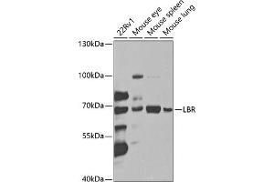 Western blot analysis of extracts of various cell lines, using LBR antibody (ABIN6128194, ABIN6143105, ABIN6143106 and ABIN6221130) at 1:1000 dilution. (Lamin B Receptor 抗体  (AA 1-211))