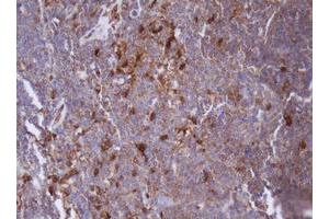Image no. 2 for anti-Isocitrate Dehydrogenase 1 (NADP+), Soluble (IDH1) antibody (ABIN1502107) (IDH1 抗体)