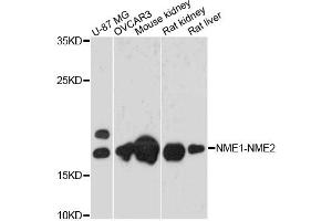 Western blot analysis of extracts of various cell lines, using NME1-NME2 antibody. (NME1-NME2 抗体)