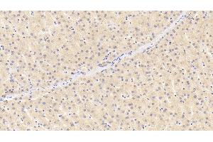 Detection of RBP4 in Human Liver Tissue using Monoclonal Antibody to Retinol Binding Protein 4 (RBP4) (RBP4 抗体  (AA 18-201))