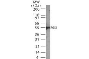 Image no. 1 for anti-Regulator of G-Protein Signaling 6 (RGS6) (AA 182-198) antibody (ABIN233211) (RGS6 抗体  (AA 182-198))