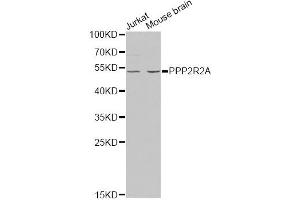 Western blot analysis of extracts of various cell lines, using PPP2R2A antibody (ABIN1874225) at 1:1000 dilution. (PPP2R2A 抗体)