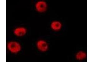 ABIN6277211 staining HepG2 by IF/ICC. (Histone 3 抗体  (H3R8me2))