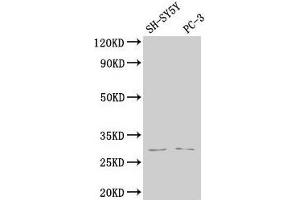 Western Blot Positive WB detected in: SH-SY5Y whole cell lysate, PC-3 whole cell lysate All lanes: APH1B antibody at 1:2000 Secondary Goat polyclonal to rabbit IgG at 1/50000 dilution Predicted band size: 29, 25 kDa Observed band size: 29 kDa (APH1B 抗体  (AA 93-110))