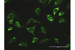 Immunofluorescence of purified MaxPab antibody to LONP1 on HeLa cell.