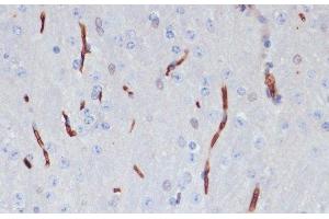 Immunohistochemistry of paraffin-embedded Mouse brain using APOA1 Polyclonal Antibody at dilution of 1:100 (40x lens). (APOA1 抗体)