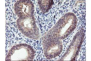 Immunohistochemical staining of paraffin-embedded Human endometrium tissue using anti-PNMT mouse monoclonal antibody. (PNMT 抗体)