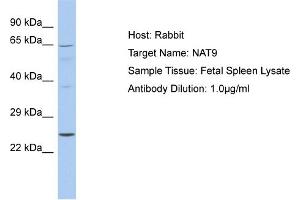 Host: Rabbit Target Name: NAT9 Sample Tissue: Human Fetal Spleen Antibody Dilution: 1ug/ml (NAT9 抗体  (C-Term))