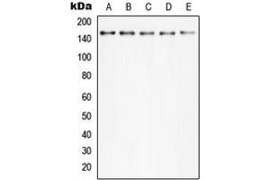 Western blot analysis of PLC gamma 2 (pY753) expression in Hela TNFa-treated (A), MCF7 (B), Raw264. (Phospholipase C gamma 2 抗体  (pTyr753))