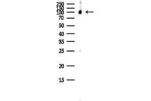 anti-ATP-Binding Cassette, Sub-Family F (GCN20), Member 1 (ABCF1) (C-Term) antibody