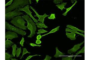 Immunofluorescence of monoclonal antibody to CTLA4 on HeLa cell. (CTLA4 抗体  (AA 36-135))