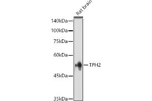 Western blot analysis of extracts of various cell lines, using TET3 antibody (ABIN6133174, ABIN6149021, ABIN6149023 and ABIN6223527) at 1:1000 dilution. (Tryptophan Hydroxylase 2 抗体  (AA 1-170))