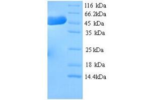 SDS-PAGE (SDS) image for Hydroxymethylglutaryl-Coa Synthase (HMCS1) (AA 1-520), (full length) protein (His tag) (ABIN5714418)