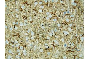 Immunohistochemistry (IHC) image for anti-Heat shock factor protein 2 (HSF2) (AA 82-102), (Middle Region) antibody (ABIN3044217)