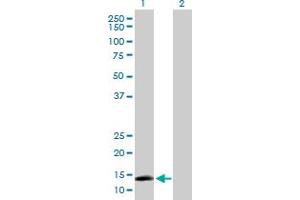 Western Blot analysis of AGTRAP expression in transfected 293T cell line by AGTRAP MaxPab polyclonal antibody. (AGTRAP 抗体  (AA 1-152))