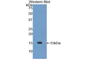 Western blot analysis of the recombinant protein. (SLC2A14 抗体  (AA 230-293))