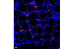 Immunofluorescence of paraffin embedded rat colon using MHC-II (ABIN7074245) at dilution of 1:500 (400x lens) (CD74 抗体)